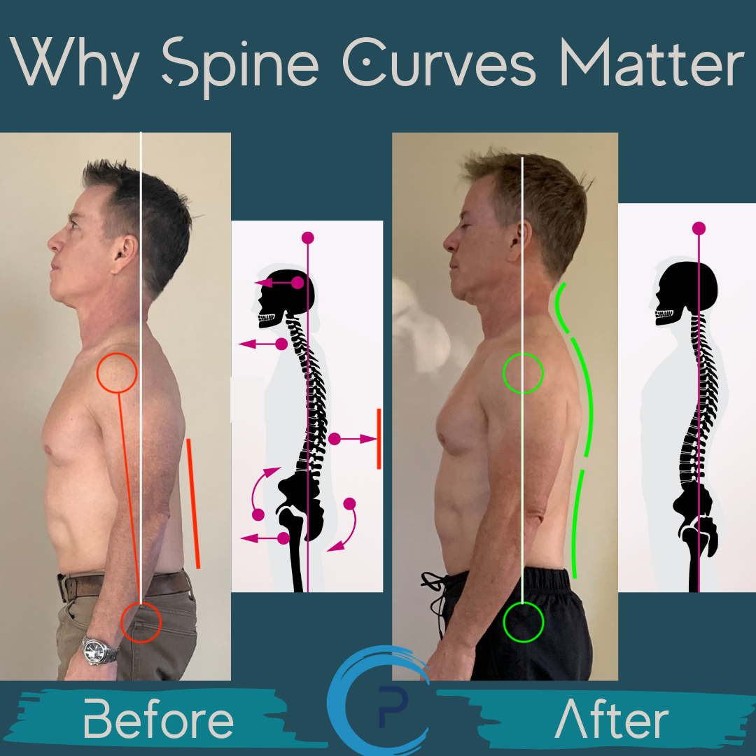 why-the-curve-of-our-spine-matters-pain-academy