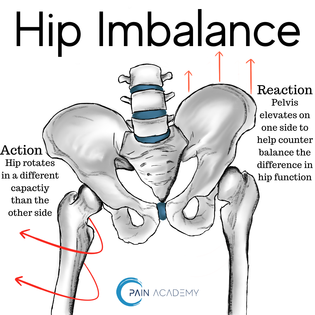 hip-pain-and-sciatica